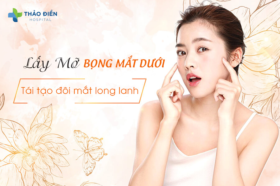 Lấy mỡ bọng mắt dưới