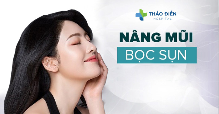 Nâng mũi bọc sụn