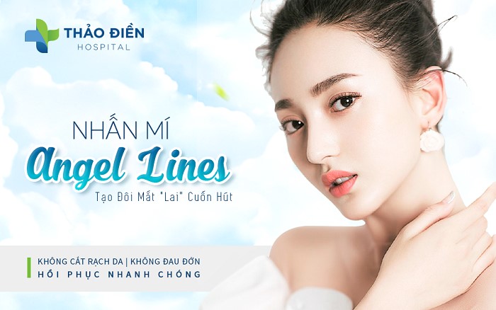 Nhấn mí Angel Eye