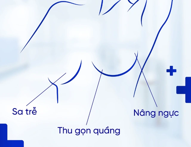 Những sai lầm cần tránh để có vết sẹo đẹp sau nâng ngực