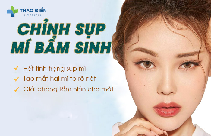 Chỉnh hình sụp mí mắt