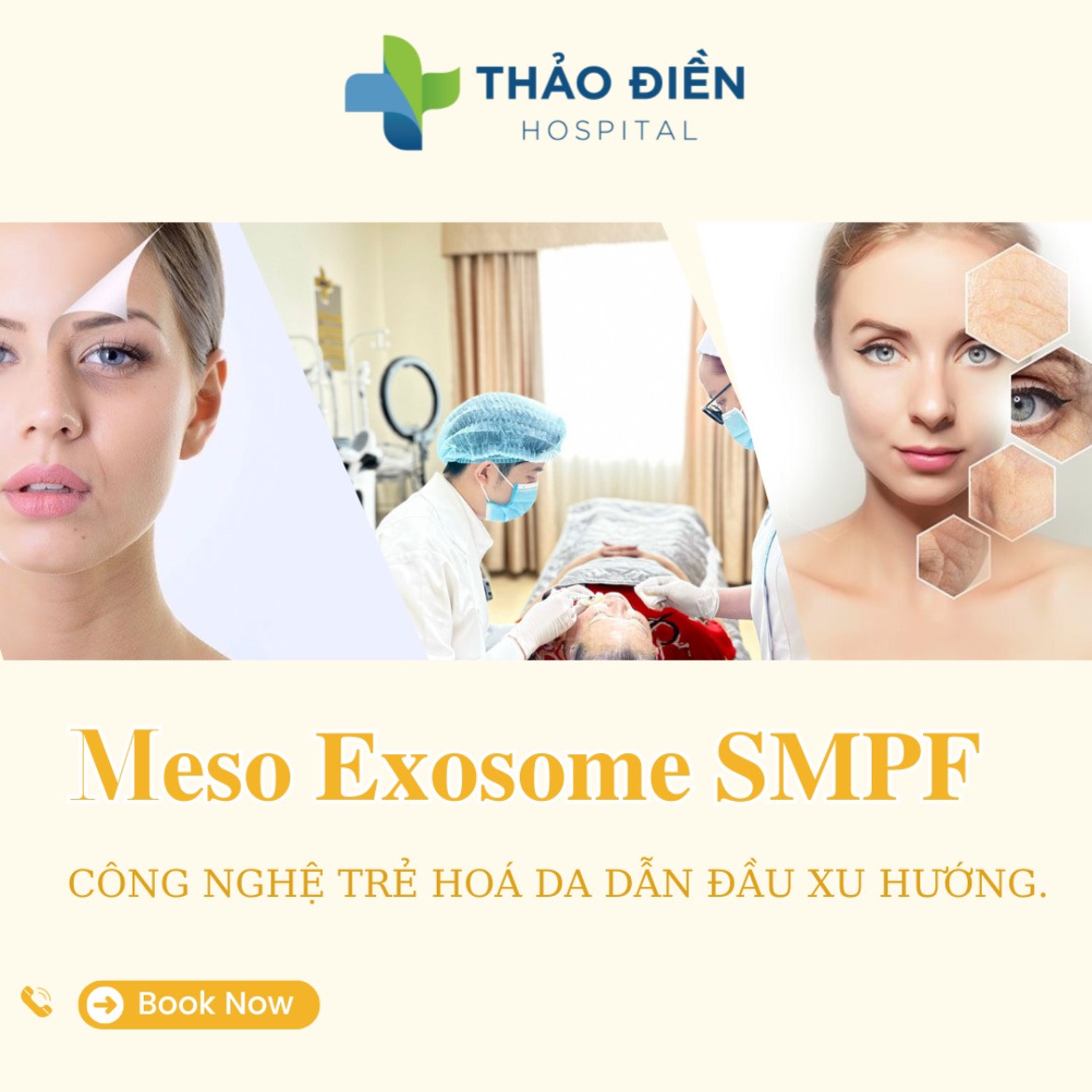 Meso injection for skin tightening