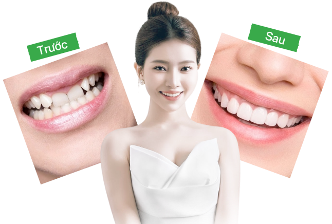 DỊCH VỤ THẨM MỸ RĂNG SỨ