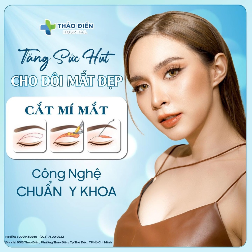 hình ảnh cắt mí mắt bệnh viện thảo điền