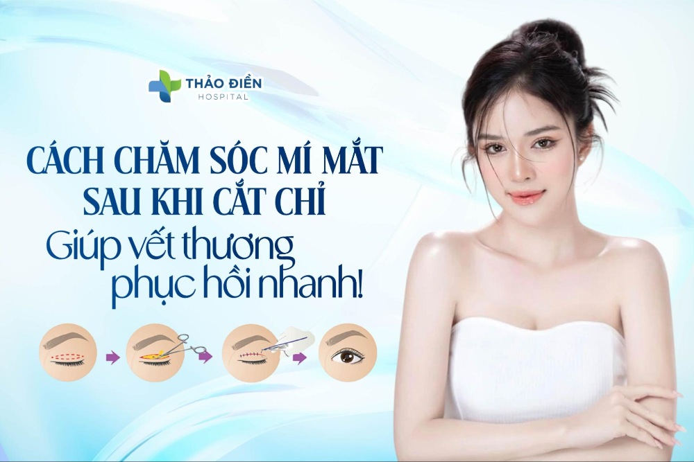 Cách chăm sóc mí mắt sau khi cắt chỉ giúp mí đẹp tự nhiên
