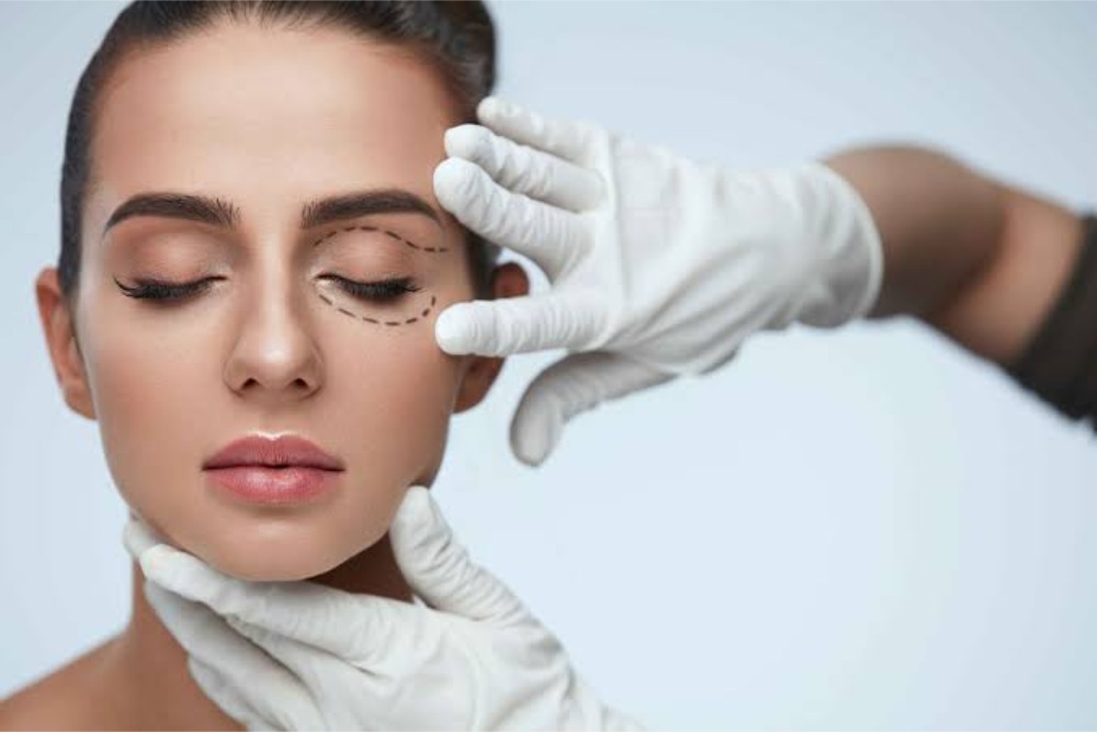 cách chăm sóc mắt sau khi cắt mí