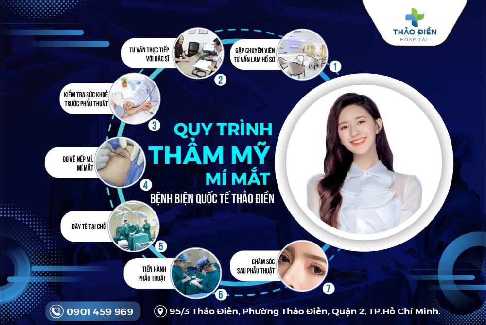 cắt mí mắt tại bệnh viện thảo điền
