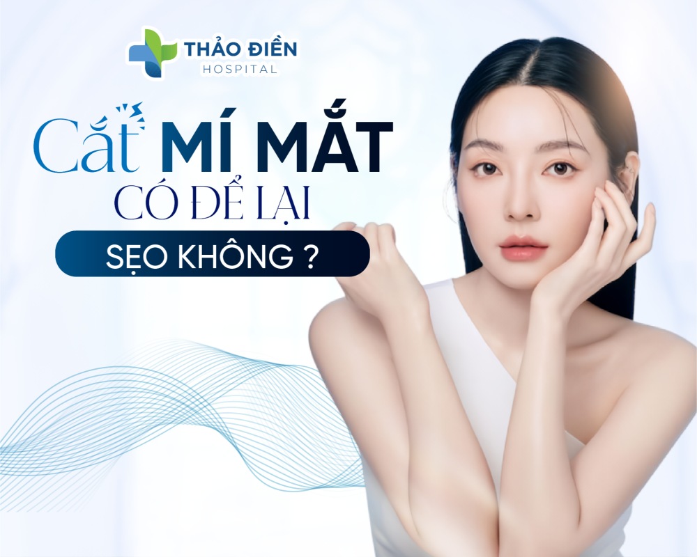 Cắt mí mắt có để lại sẹo không? Cách chăm sóc để không bị sẹo