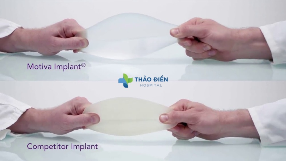 địa chỉ nâng ngực uy tín TPHCM hiện nay