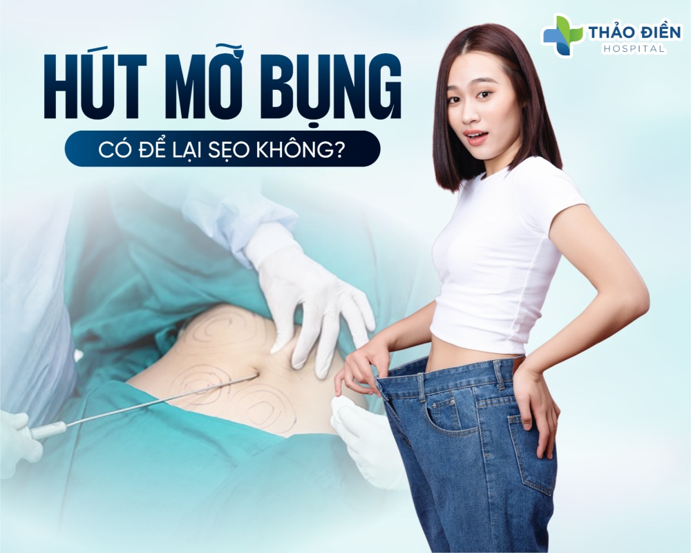 Hút mỡ bụng có để lại sẹo không? Các câu hỏi thường gặp