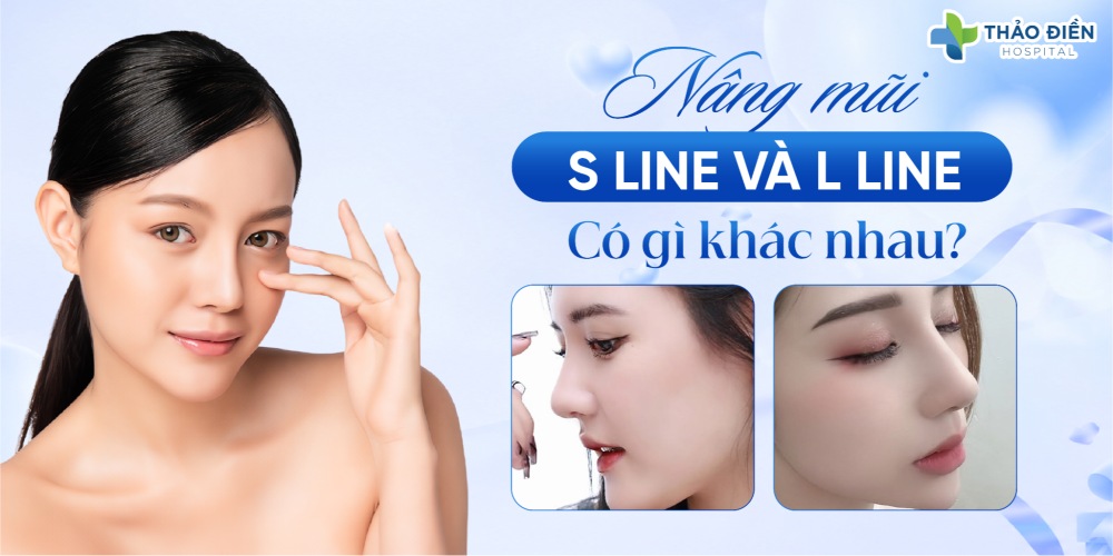 Nâng mũi S line và L line có gì khác nhau?