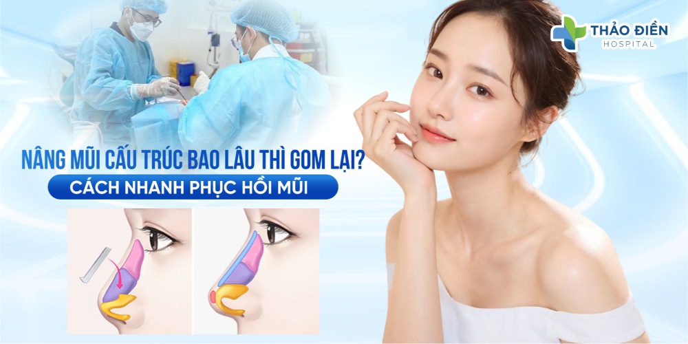 How Long Does It Take for Structural Rhinoplasty to Settle? Tips for Faster Recovery