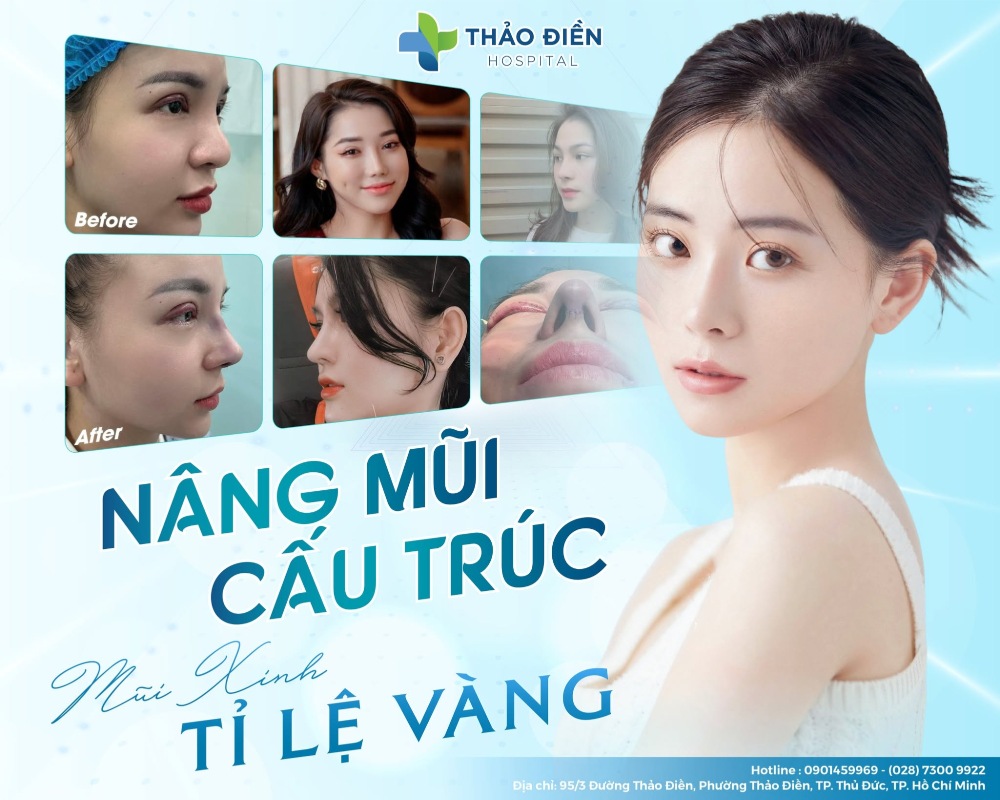nâng mũi cấu trúc an toàn tại bệnh viện thảo điền