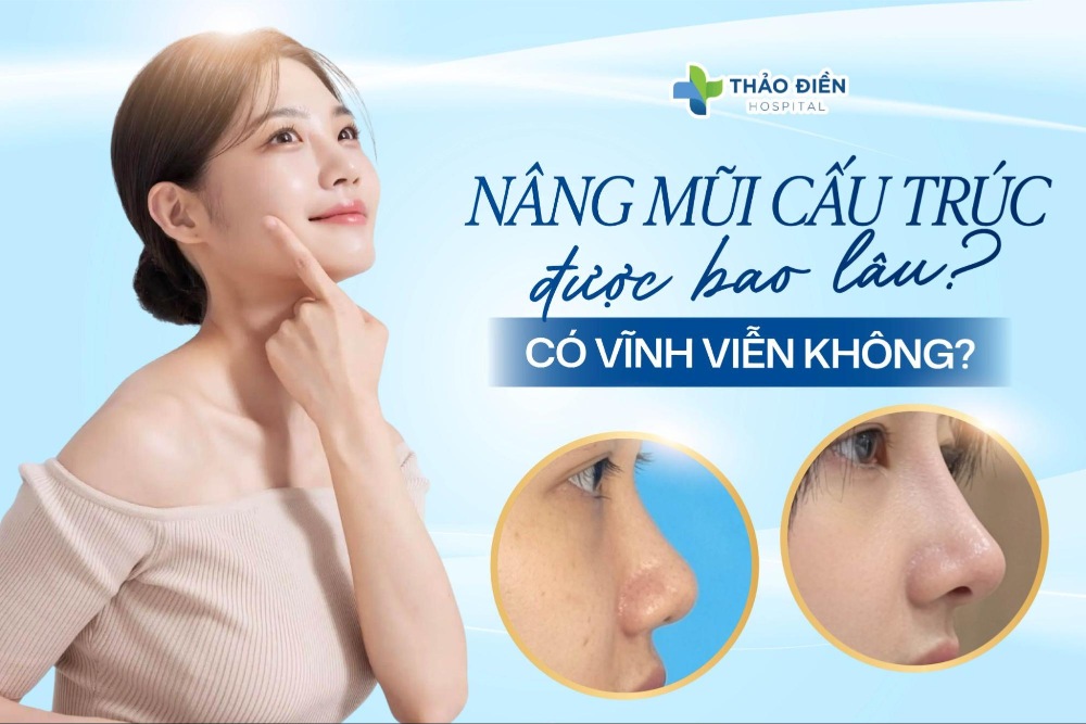 Nâng mũi cấu trúc được bao lâu, có vĩnh viễn không?