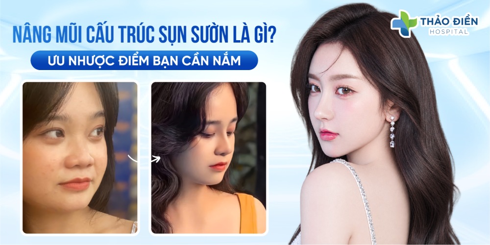 Nâng mũi cấu trúc sụn sườn là gì? Ưu nhược điểm bạn cần biết