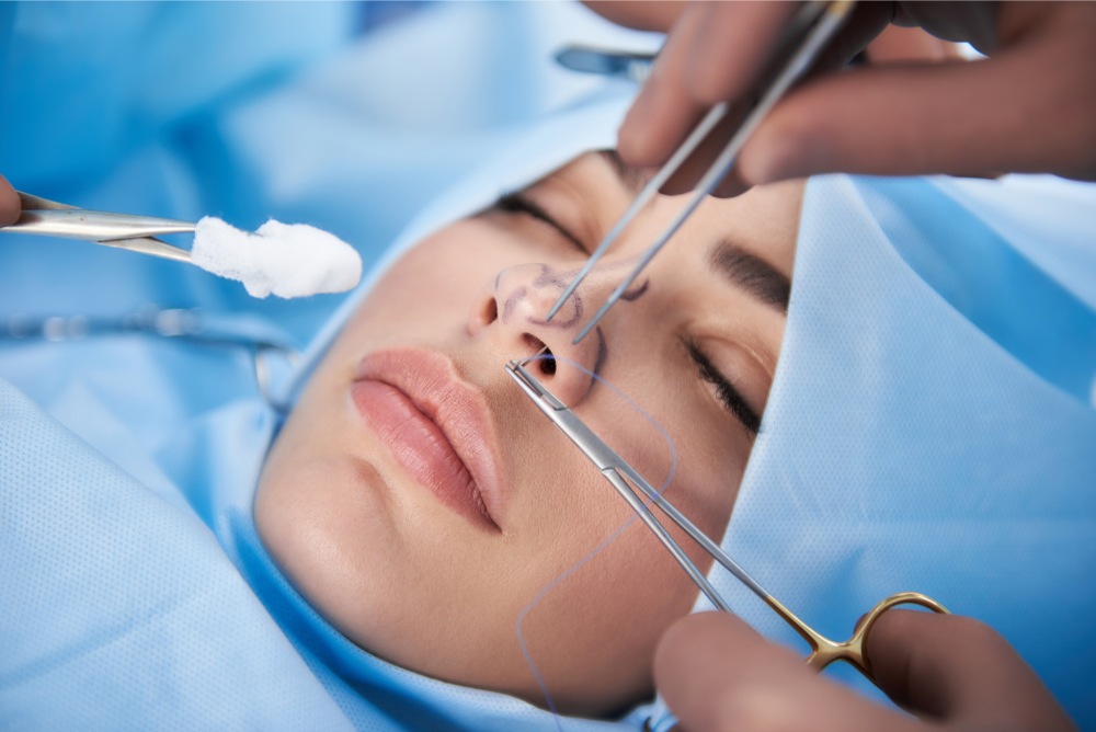 nâng mũi cấu trúc sụn sườn sinh học