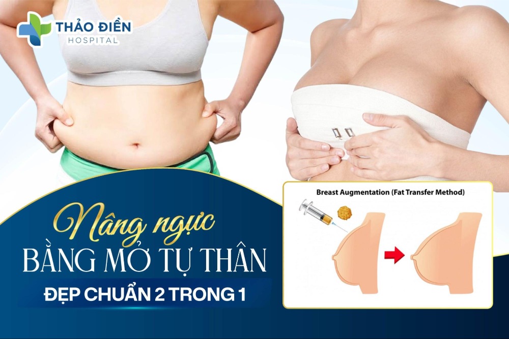 Nâng ngực bằng mỡ tự thân giữ được bao lâu, có an toàn không?