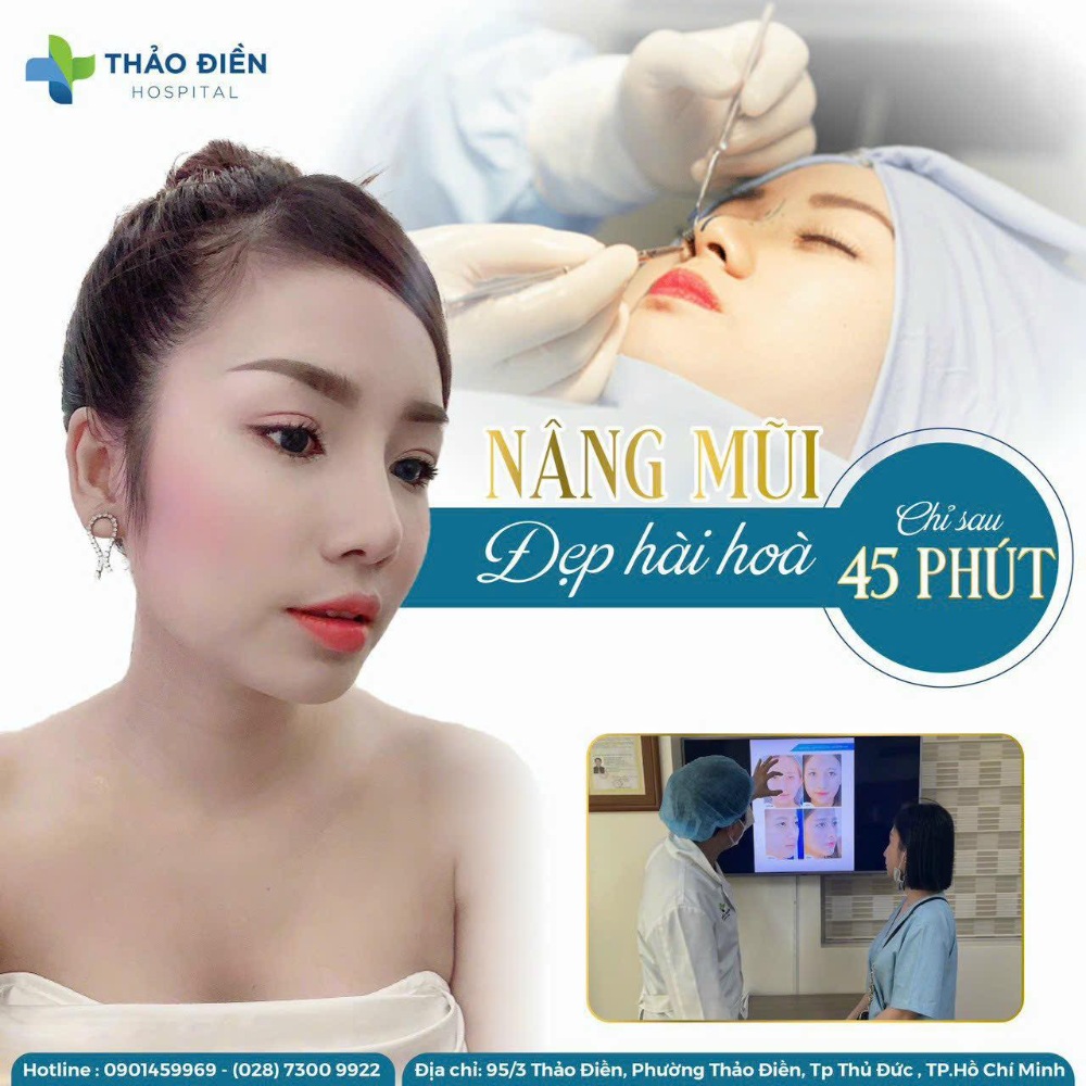 nơi sửa mũi uy tín