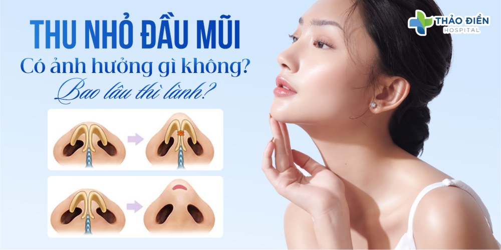 Thu nhỏ đầu mũi có ảnh hưởng gì không, bao lâu thì lành?
